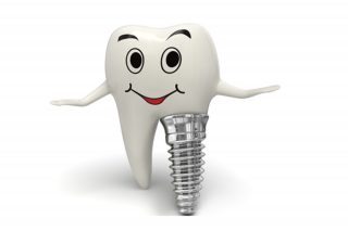Implant dentar premium. Implant dentar din titan sau zirconiu.